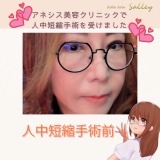 アネシス美容クリニックで人中短縮手術を受けました(^^)